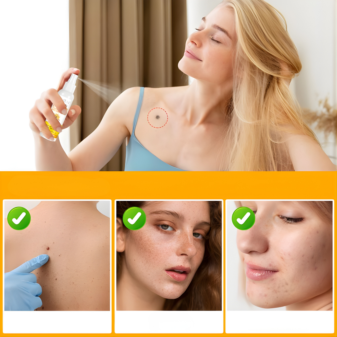 🐝TAG RECEDE🐝 ELIMINA VERRUGAS Y LUNARES DE FORMA NATURAL Y RAPIDA, + ENVÍO GRATIS A TODA GUATEMALA