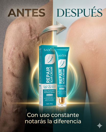 Crema Reparadora SADOER — Reduce cicatrices, manchas y textura irregular