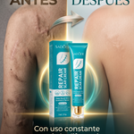 Crema Reparadora SADOER — Reduce cicatrices, manchas y textura irregular