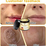 🎁 Paga 1 - Lleva 2 😍 🌿Bee Venom Cream ✨¡Elimina una amplia gama de problemas de la piel