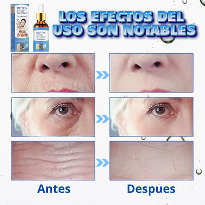 🌸🌺  Sérum Magic Botox – Rejuvenece tu piel sin agujas 🌺 🌸
