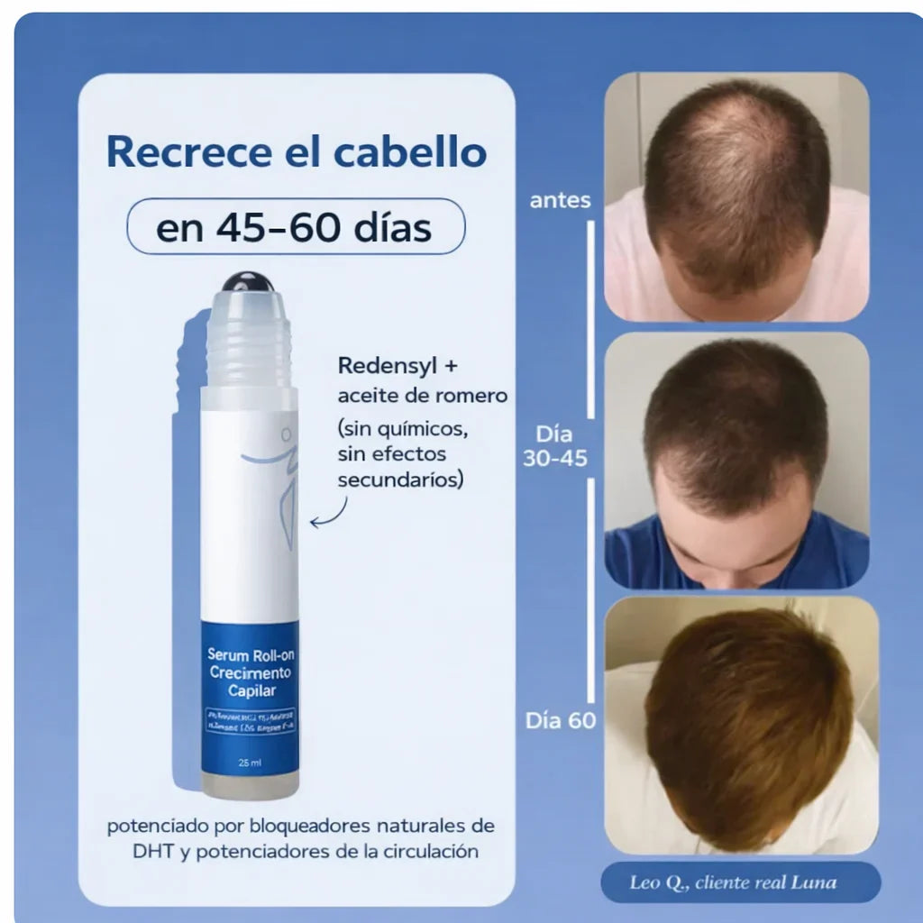 🌿BE BODYWISE: Roll On Capilar que Reactiva Folículos y Fortalece el Crecimiento del Cabello