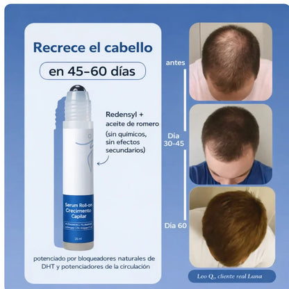 🌿BE BODYWISE: Roll On Capilar que Reactiva Folículos y Fortalece el Crecimiento del Cabello