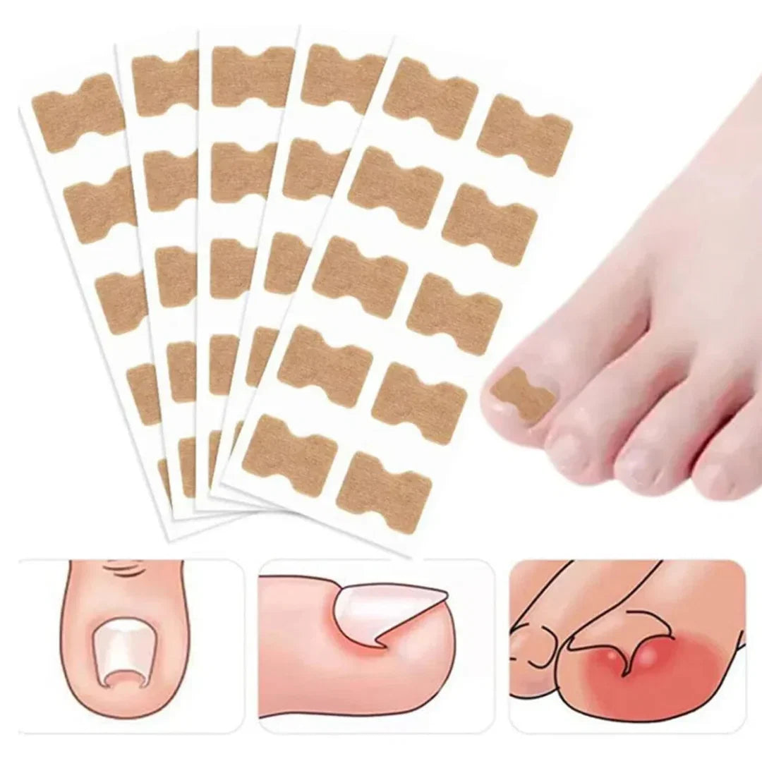 Parche Corrector de Uñas