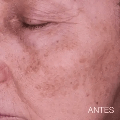 Jabón de Cúrcuma Natural -   ¡LIBERATE DE LAS MANCHAS Y EL ACNE! 🧼🍂 Paga 1 y Lleva 2😱